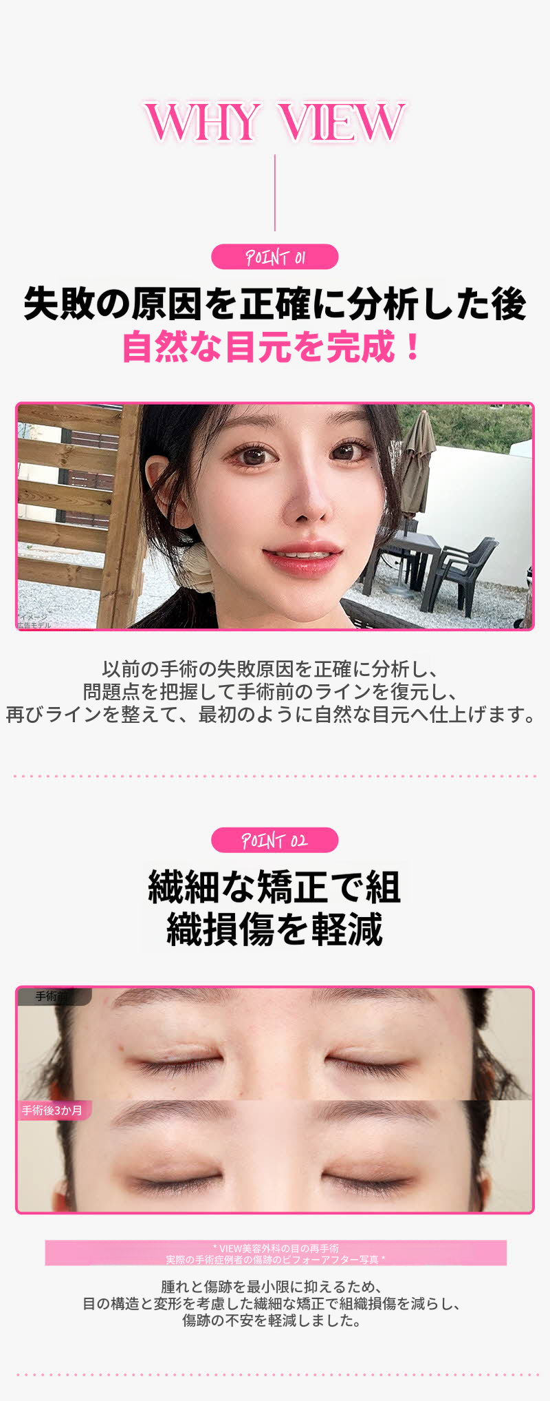 ❤️ビュー❤️目の再手術