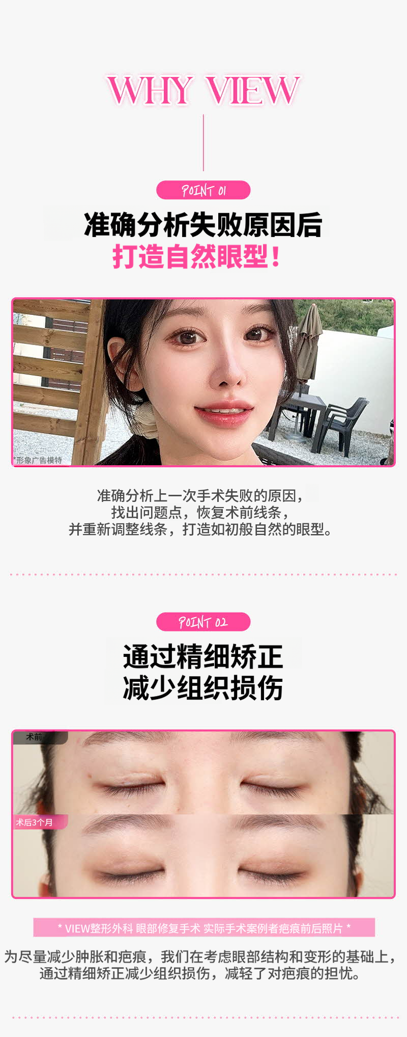 ❤️视觉❤️眼睛再手术