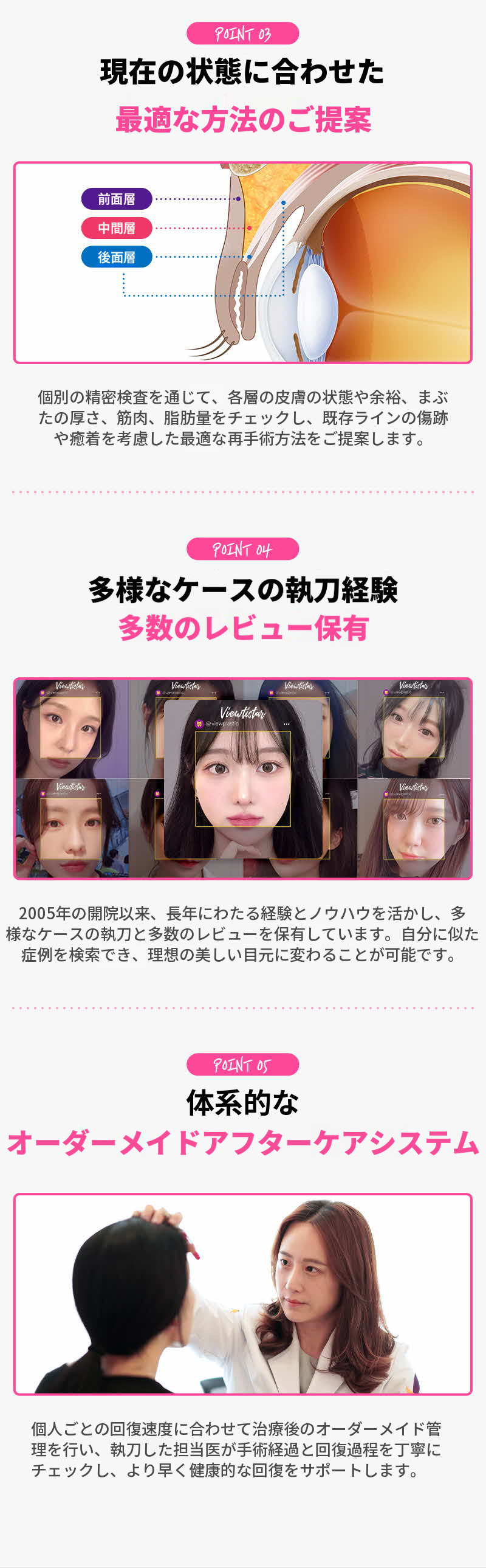 ❤️ビュ❤️目の再手術