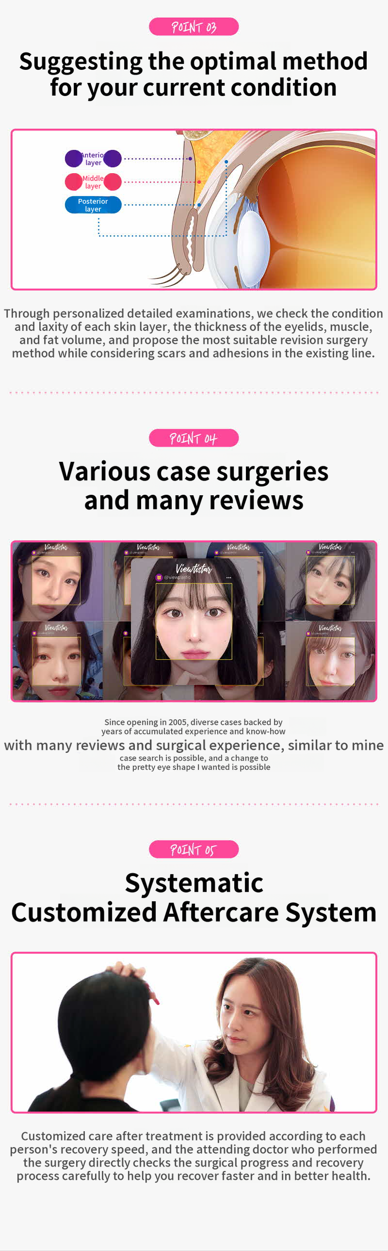 ❤️View❤️Eye Reoperation