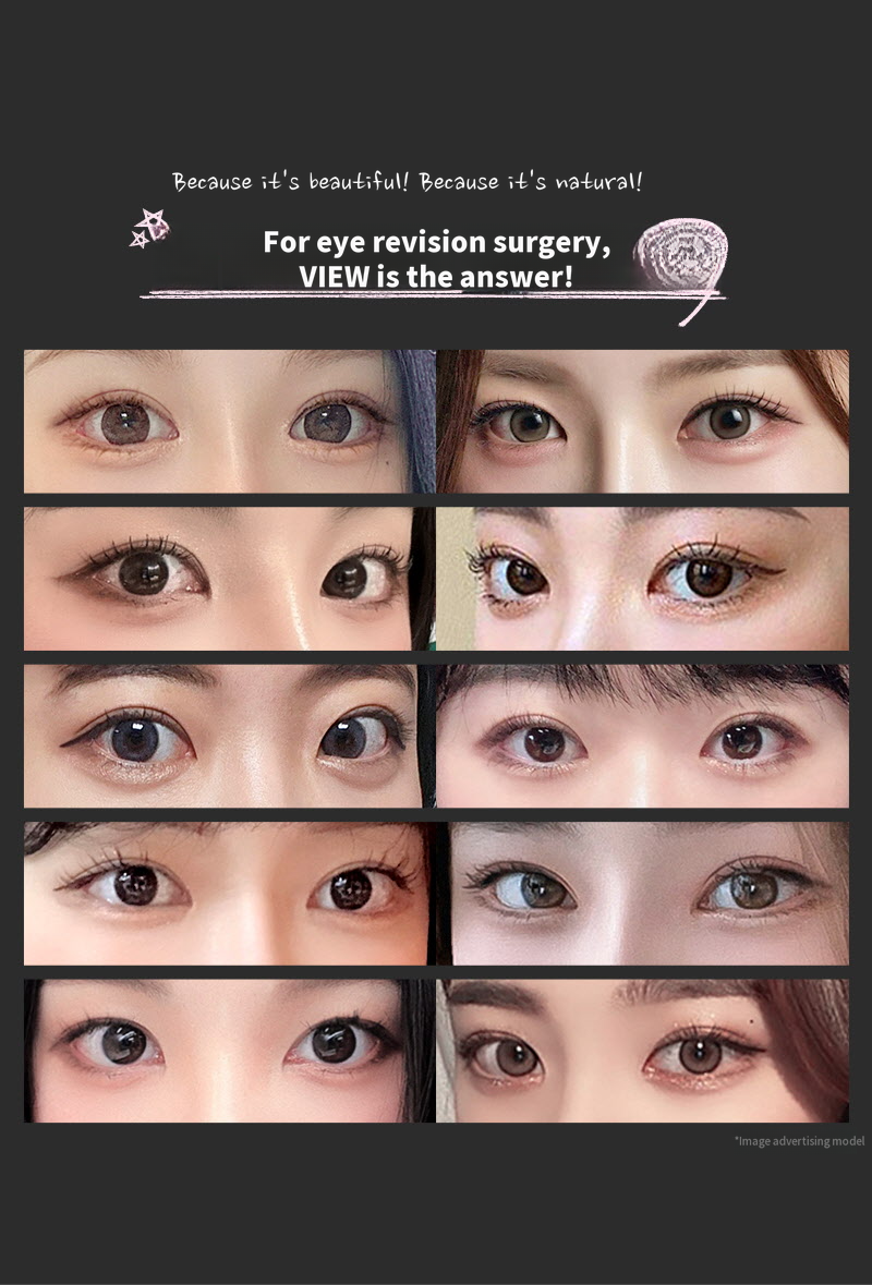 ❤️View❤️ Eye Surgery Revision