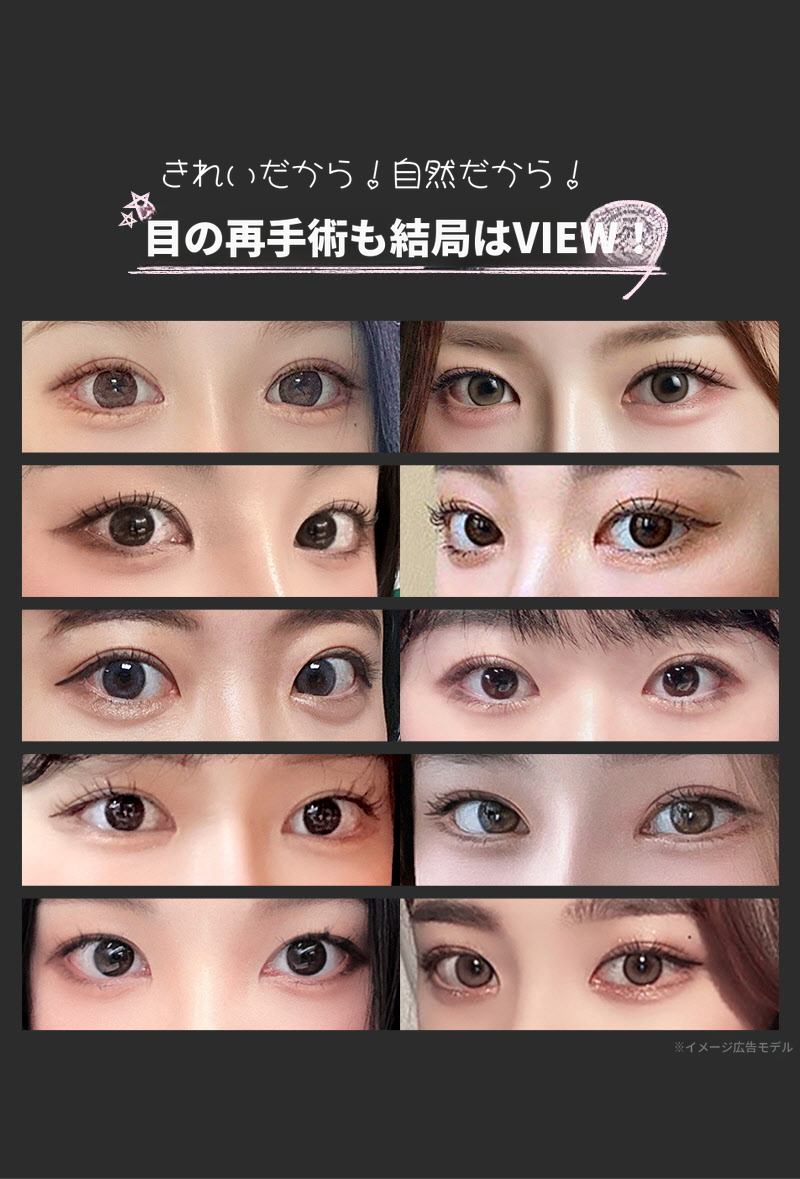 ❤️ビュ❤️目の再手術