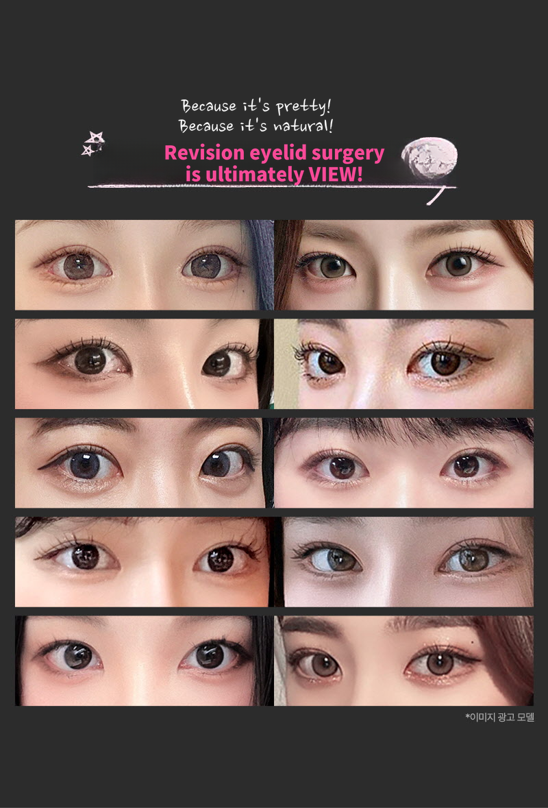 ❤️View❤️Eye Reoperation