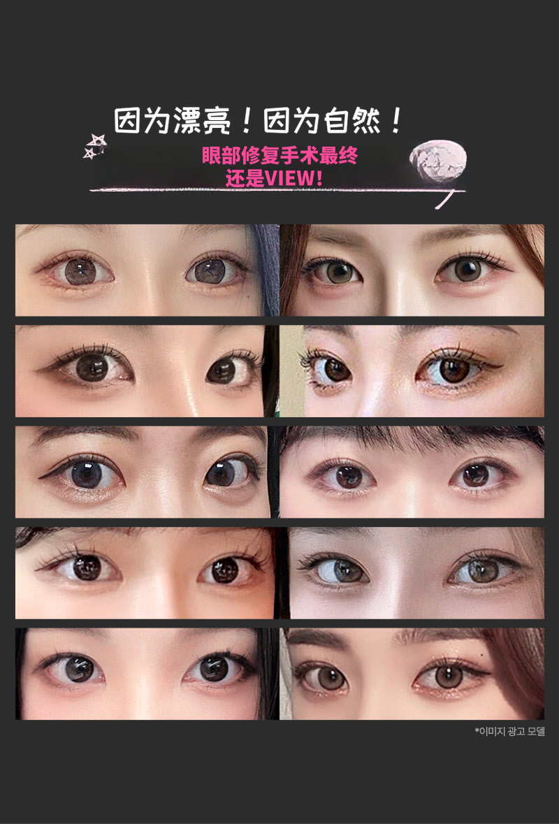 ❤️视觉❤️眼睛再手术