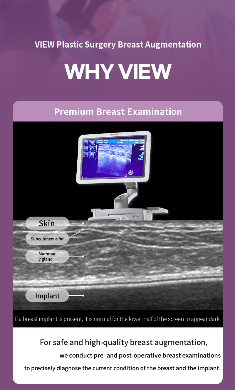 ❤️View❤️ Motiva Breast Augmentation