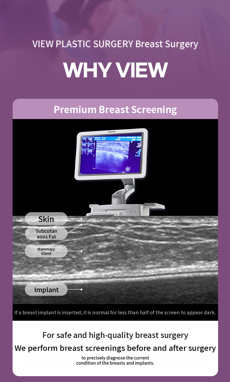 ❤️View❤️ Motiva Breast Surgery