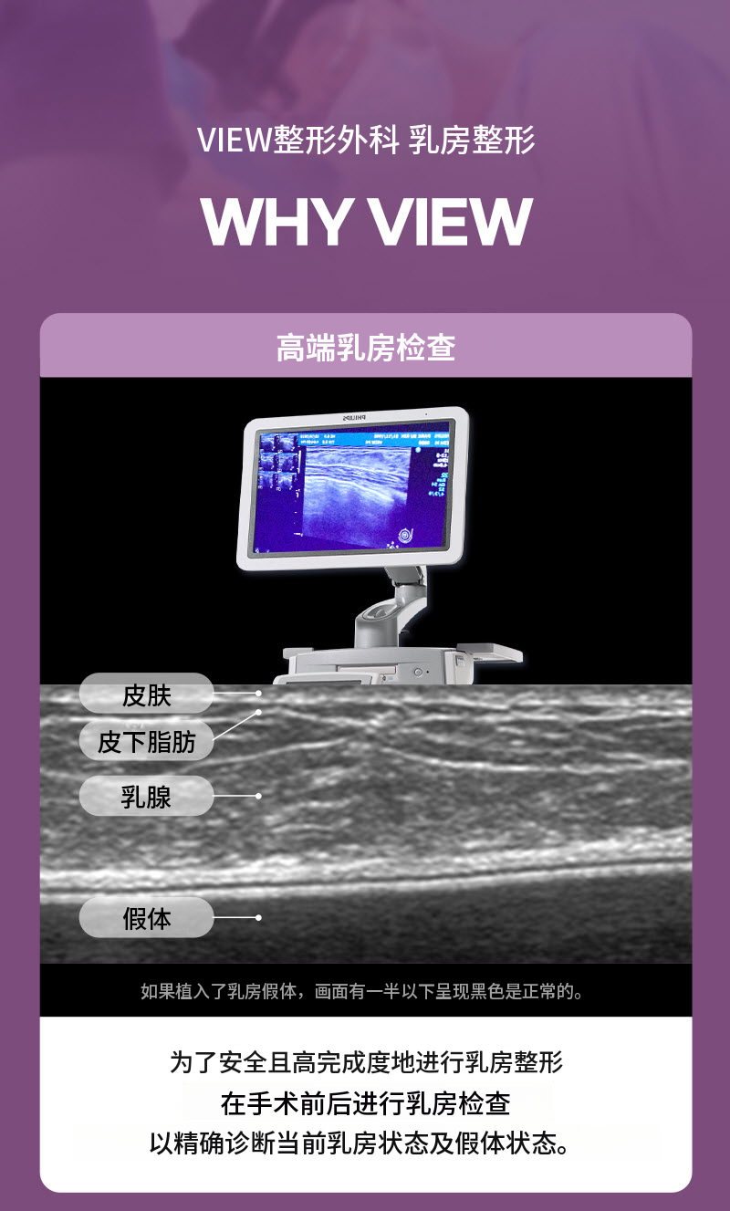 ❤️视图❤️ Motiva 胸部整形