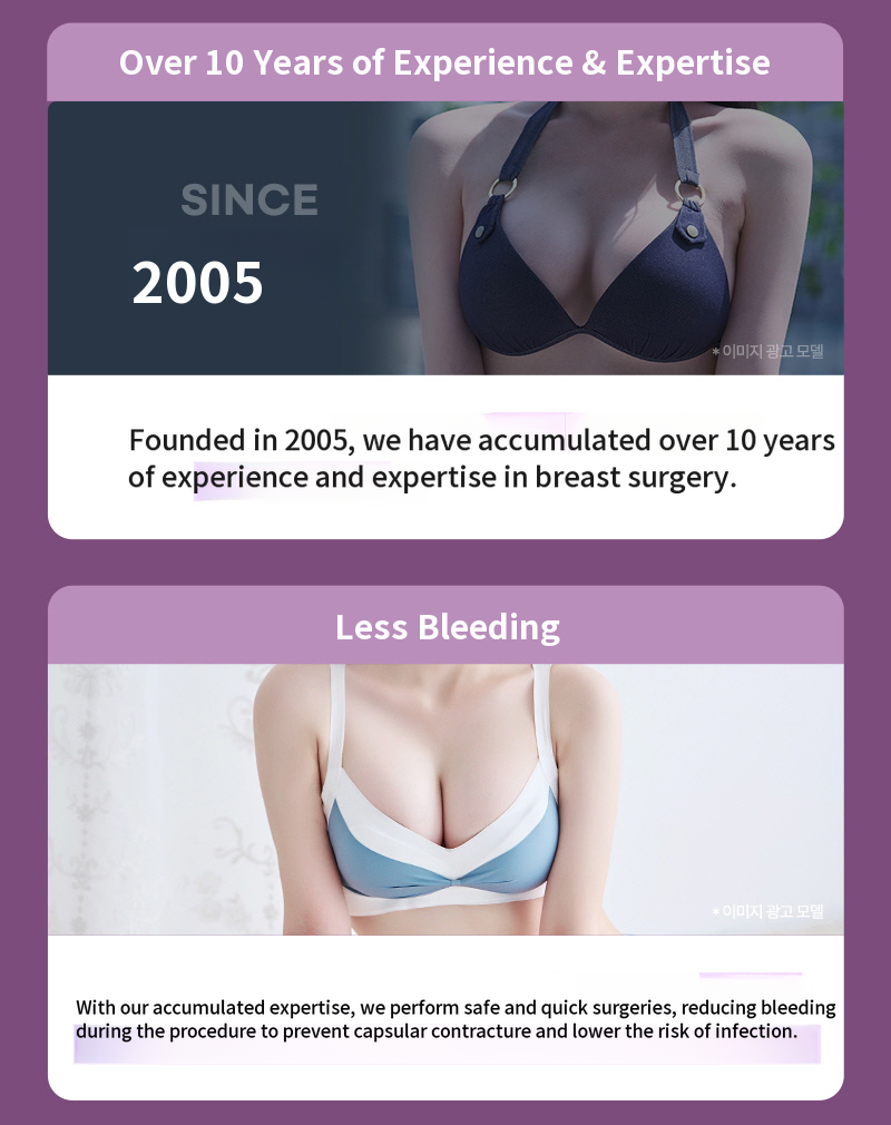 ❤️View❤️ Motiva Breast Augmentation