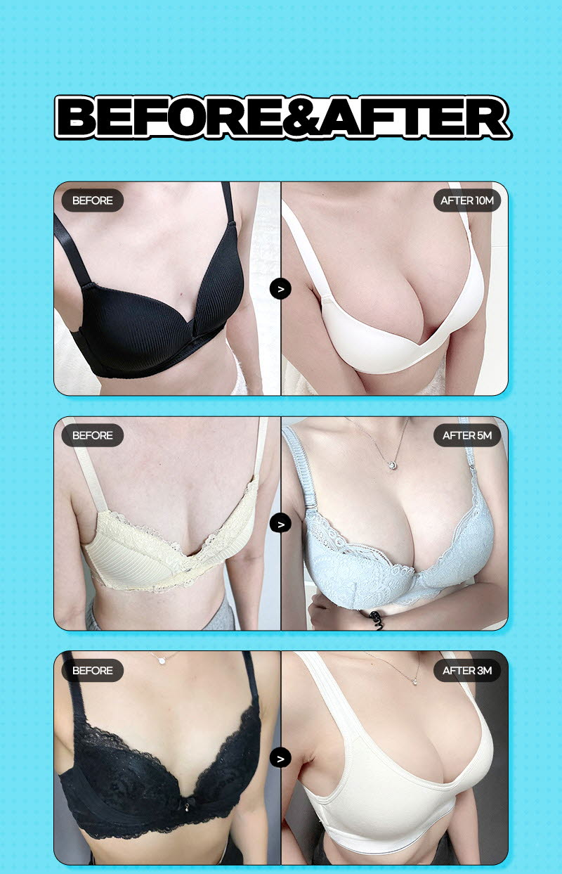 ❤️View❤️ Sebin Breast Surgery