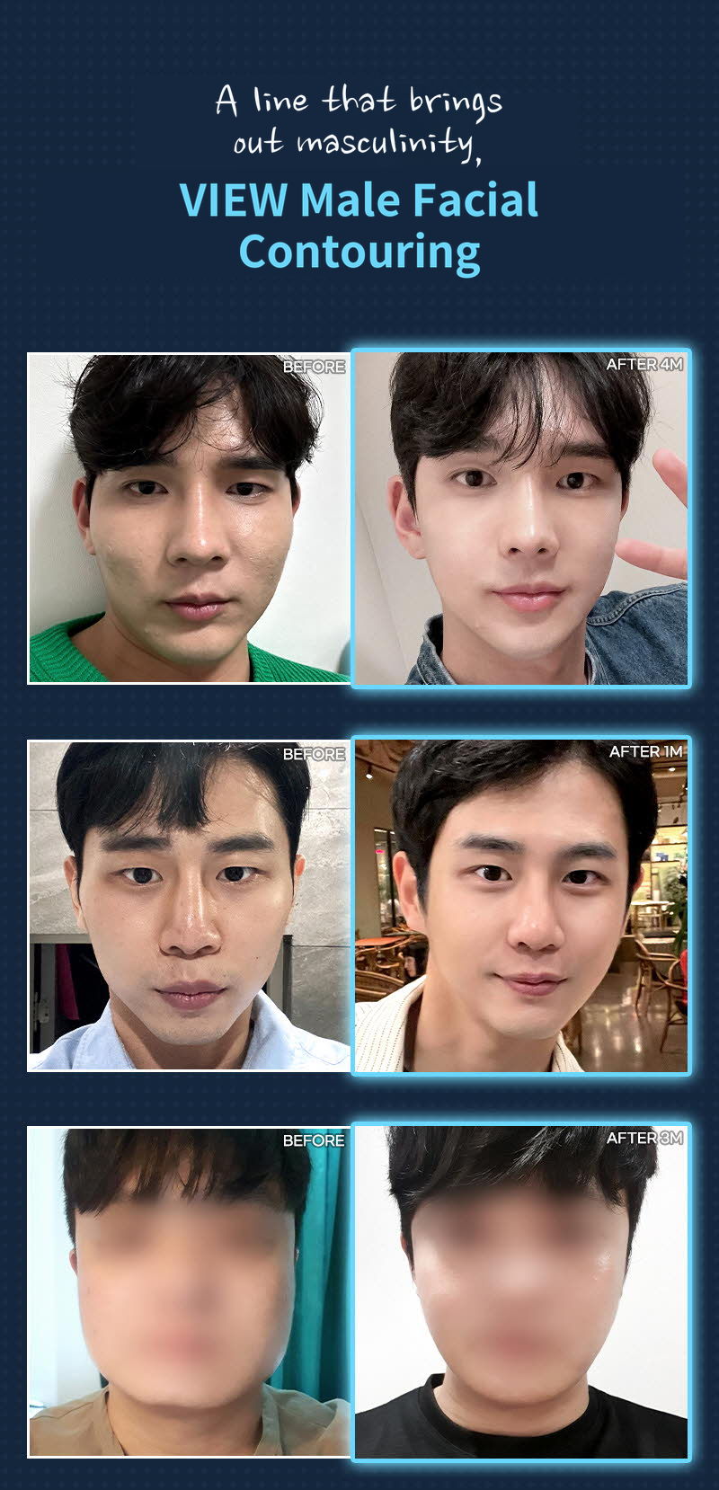 ❤️View❤️Men's Facial Contouring