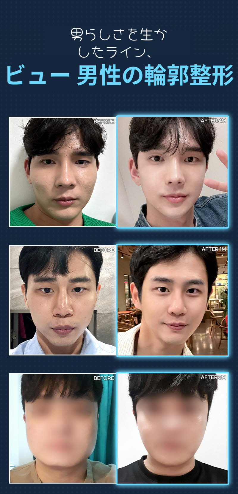 ❤️ビュー❤️男性顔面輪郭