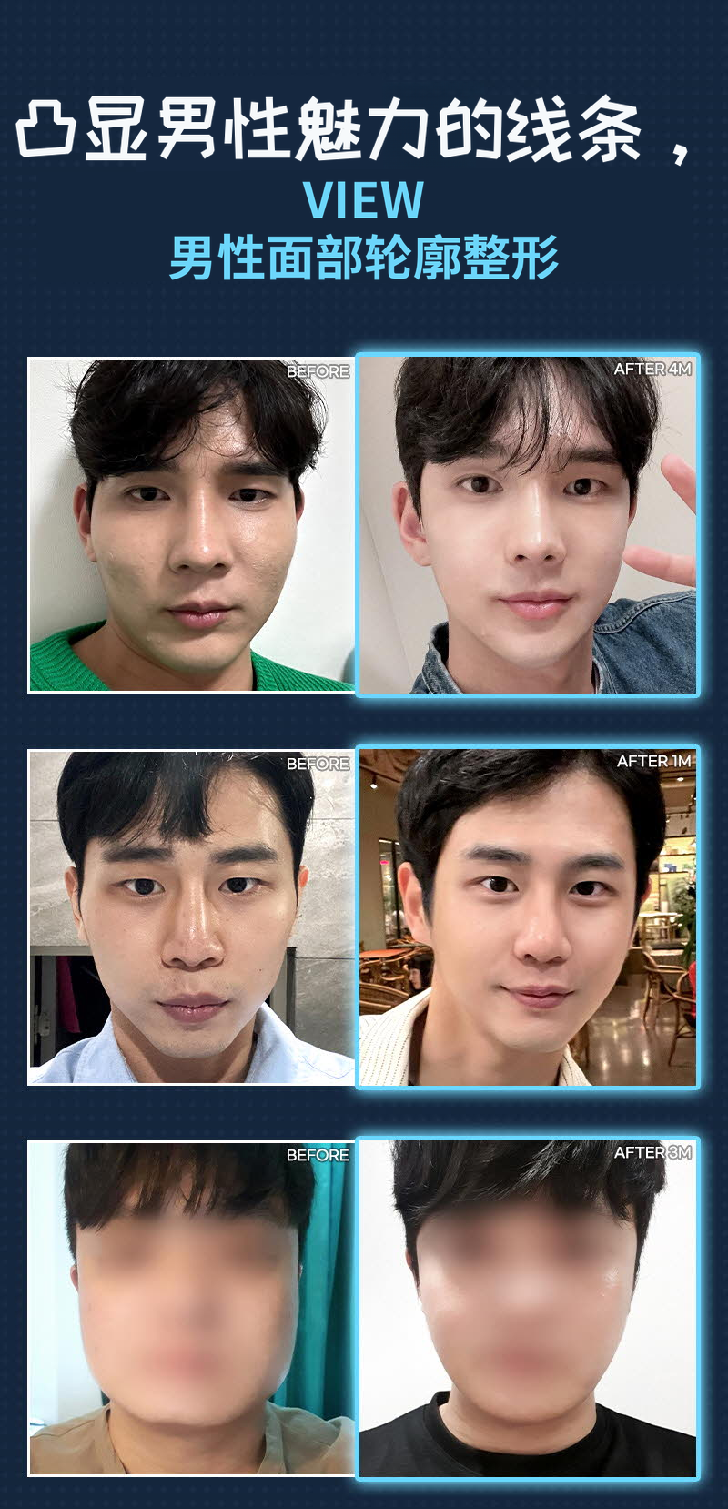❤️轮廓❤️男士面部轮廓