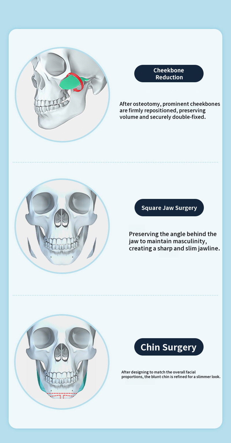 ❤️View❤️ Male Facial Contouring