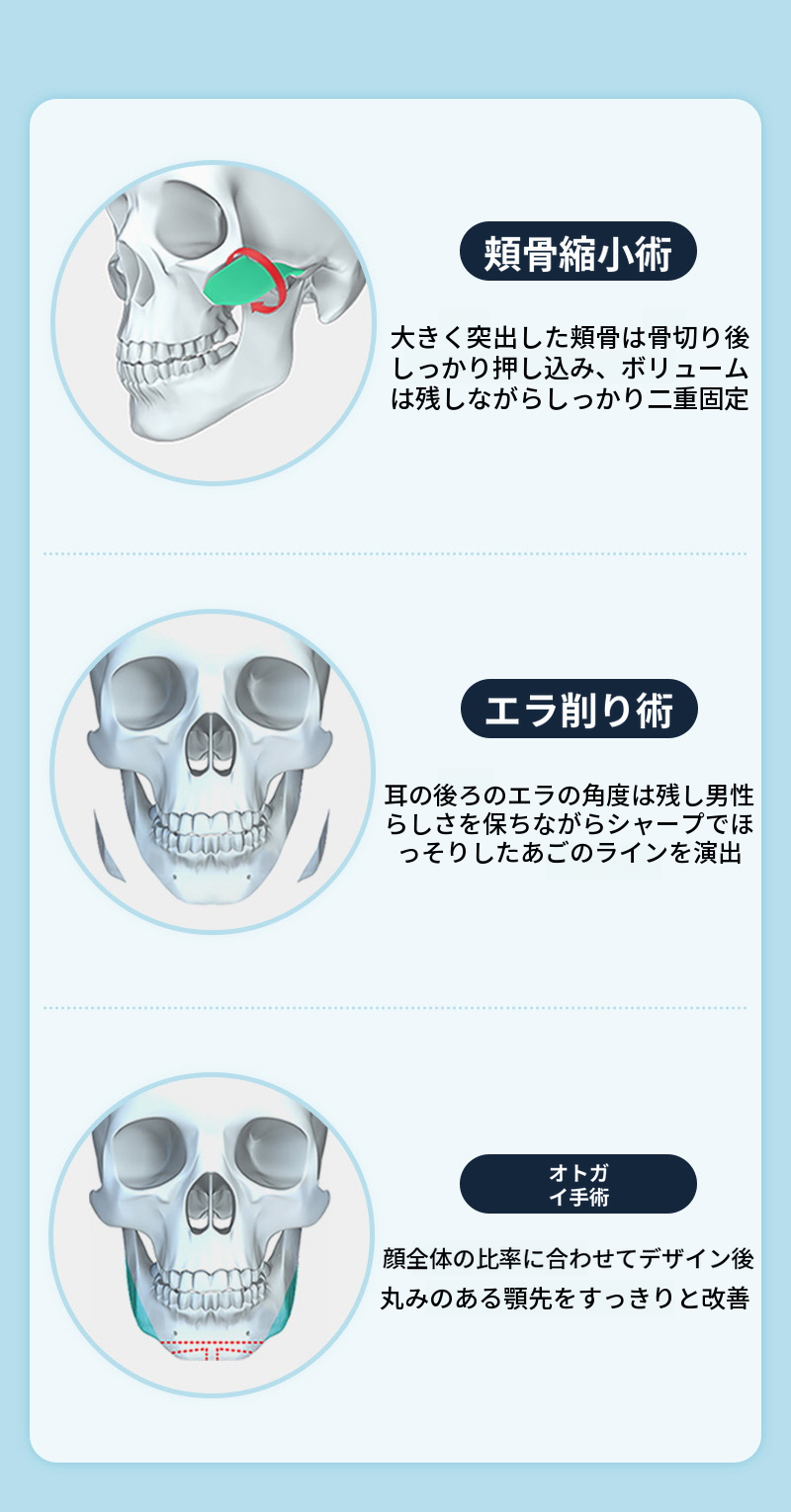 ❤️ビュー❤️男性顔面輪郭