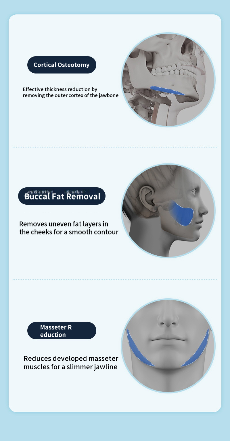 ❤️View❤️ Male Facial Contouring