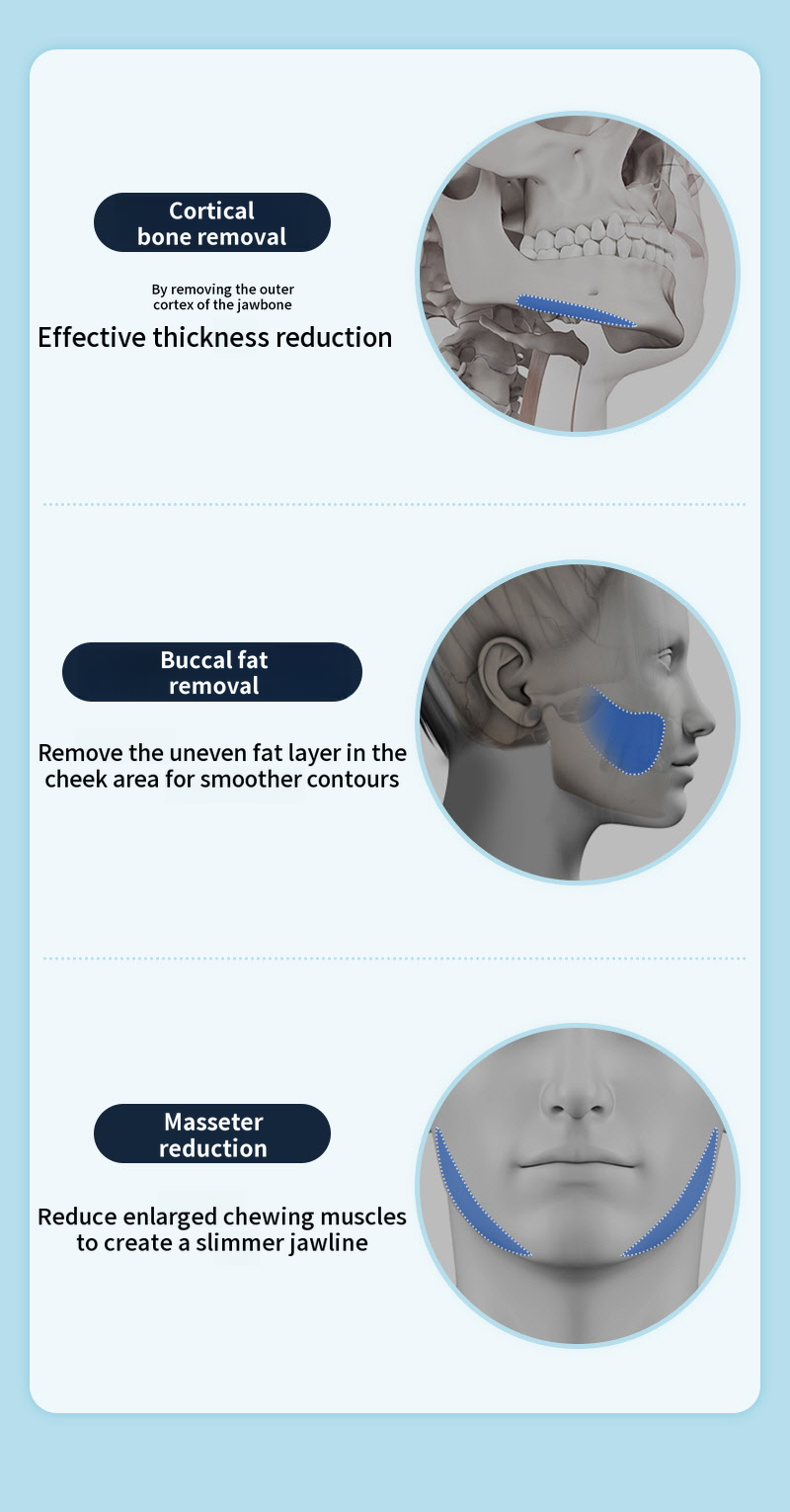❤️View❤️Men's Facial Contouring