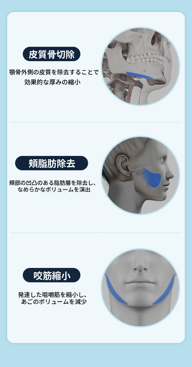 ❤️ビュー❤️男性顔面輪郭
