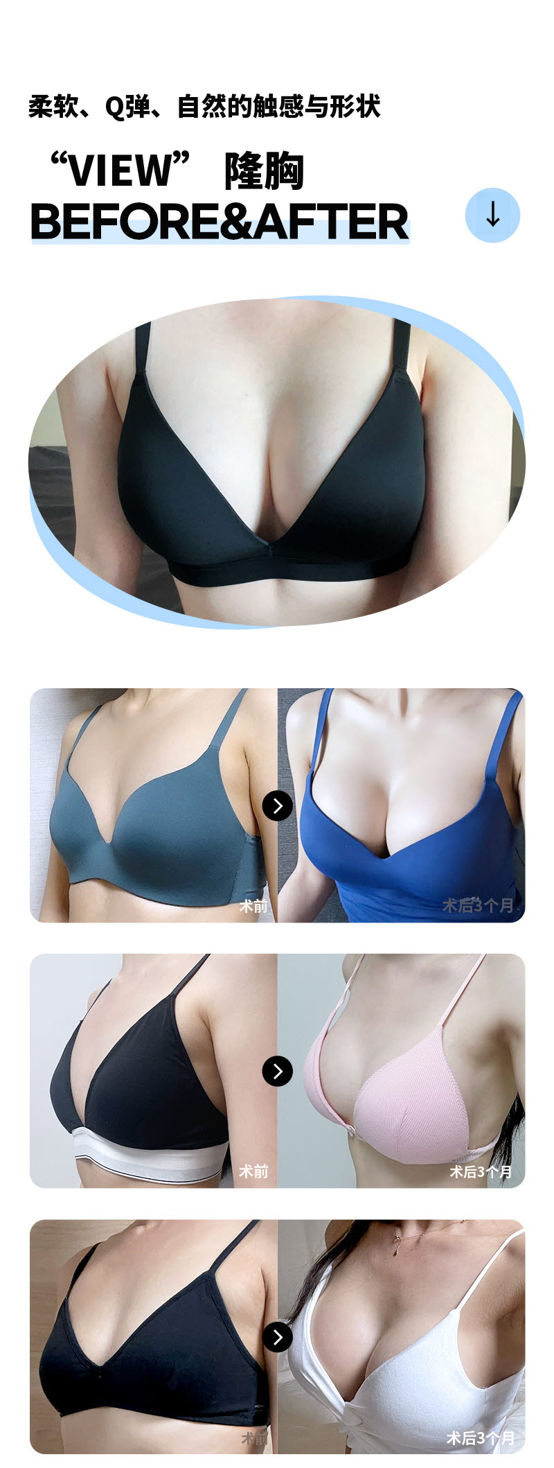 ❤️视❤️导师 胸部整形