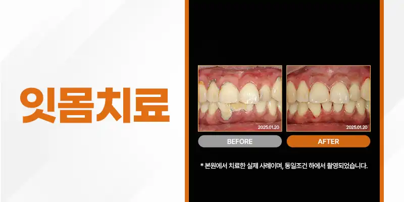 서울으뜸치과의원 3