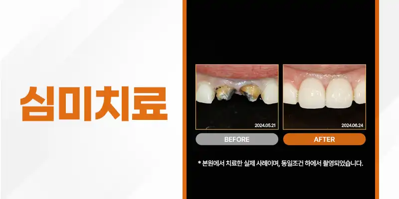 서울으뜸치과의원 4