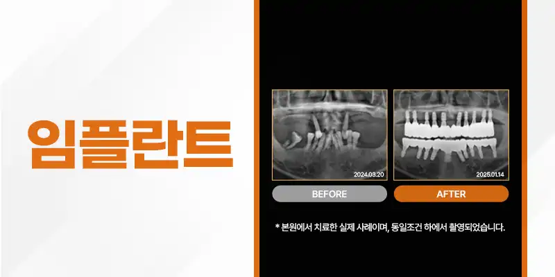 서울으뜸치과의원 2