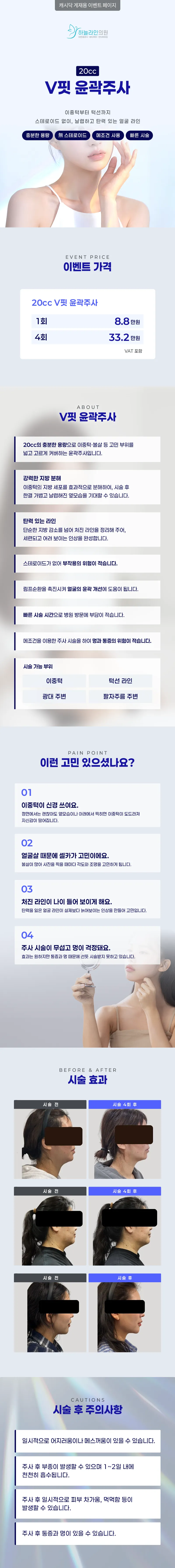 하늘라인의원 V핏 윤곽주사 이벤트, 시술 상세 이미지