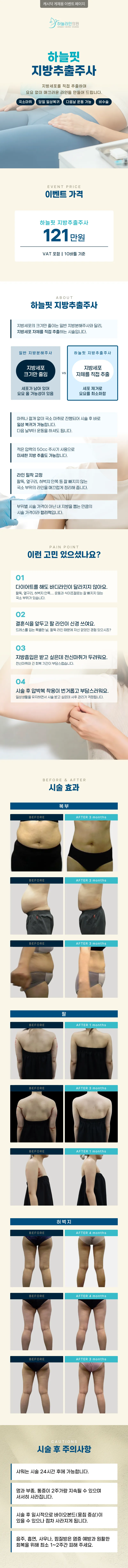 하늘라인의원 하늘핏 지방추출주사 이벤트, 시술 상세 이미지