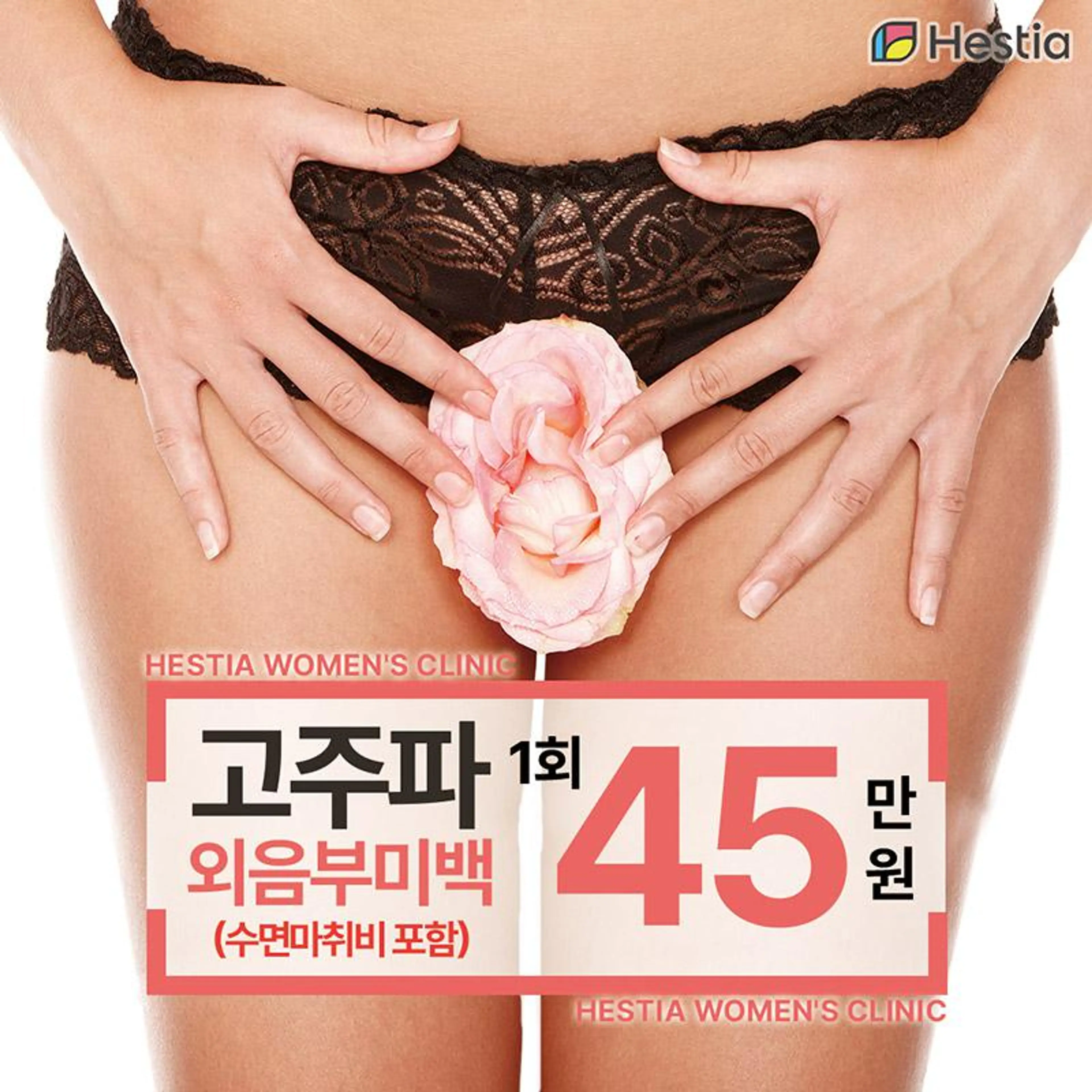 소문난 고주파 외음부미백