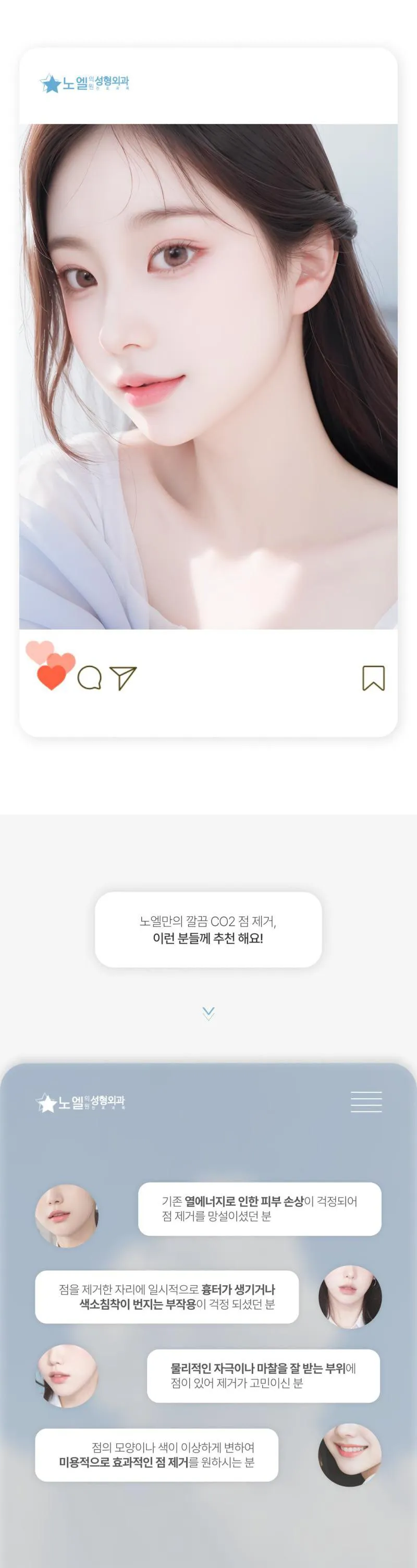 노엘의원 노엘 점제거 이벤트, 시술 상세 이미지