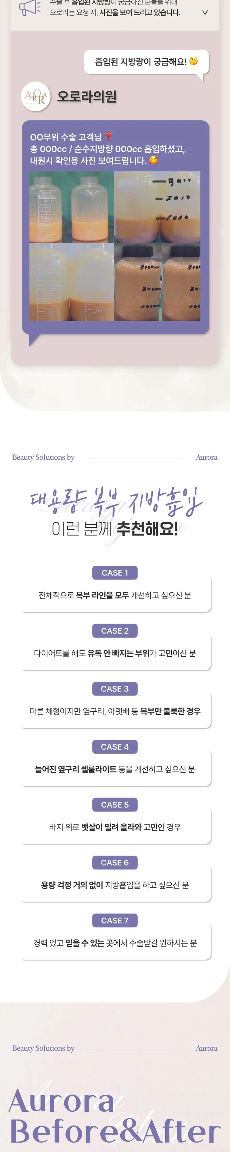 오로라의원  무제한 360도 복부 지방흡입 이벤트, 시술 상세 이미지