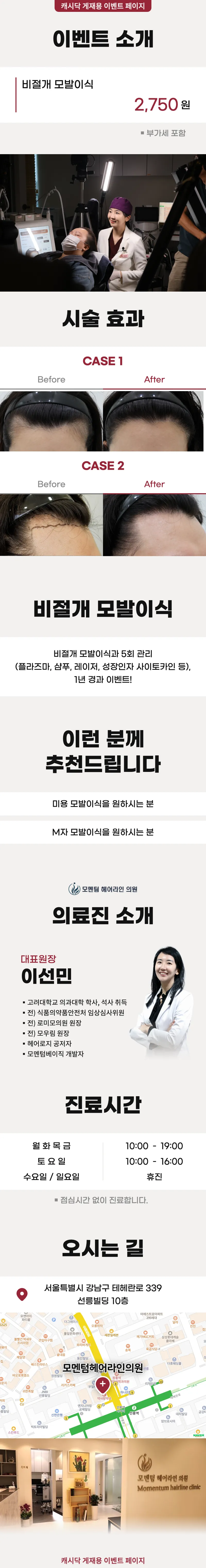 모멘텀헤어라인의원 모멘텀 비절개 모발이식 이벤트 이벤트, 시술 상세 이미지