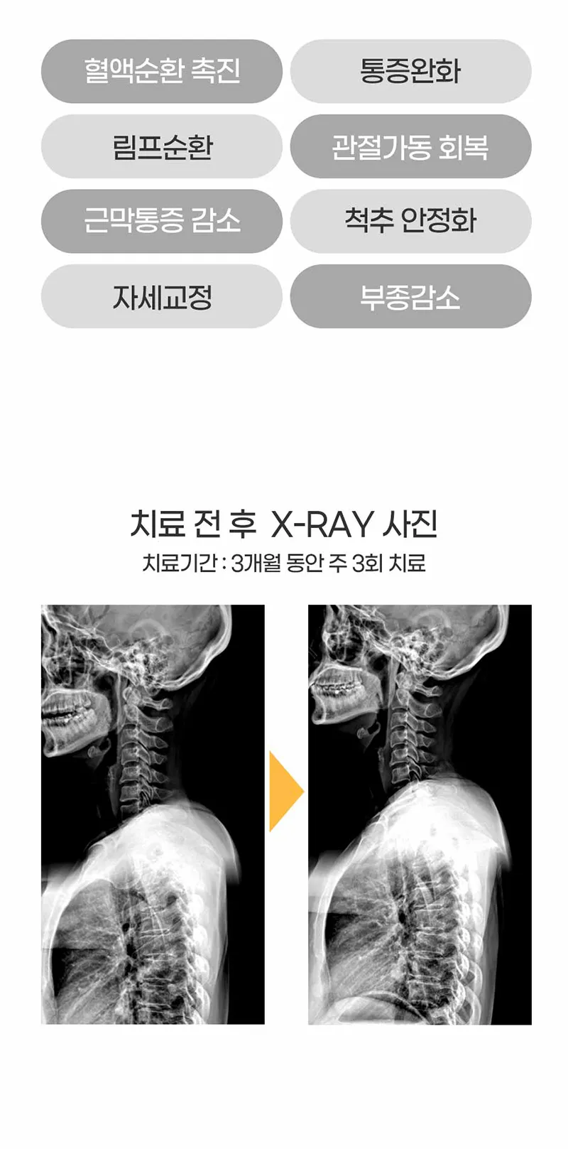 본라인의원 통증의 원인을 개선해주는 도수치료 이벤트, 시술 상세 이미지