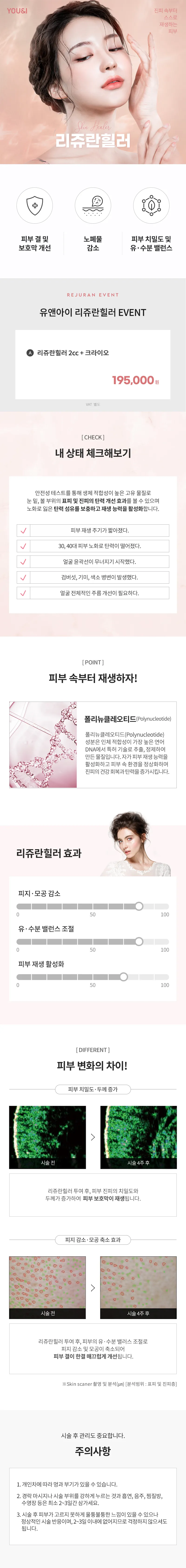 유앤아이의원 창원점 창원) 피부재생 리쥬란힐러 이벤트, 시술 상세 이미지
