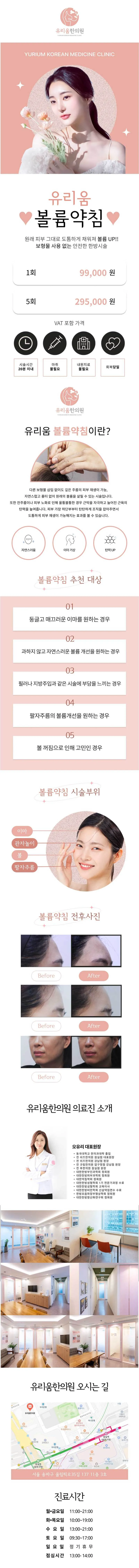 유리움한의원 유리움 볼륨약침 이벤트, 시술 상세 이미지