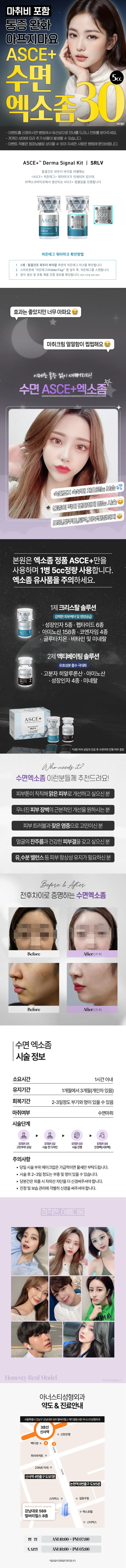 아너스티성형외과 ASCE+ 수면엑소좀💛 이벤트, 시술 상세 이미지