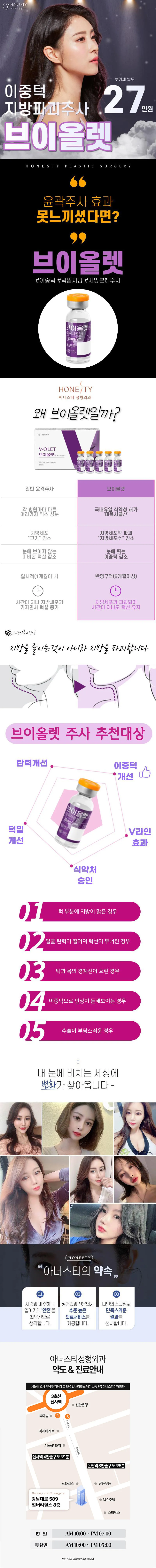 아너스티성형외과 🧡이중턱지방❌브이올렛 이벤트, 시술 상세 이미지
