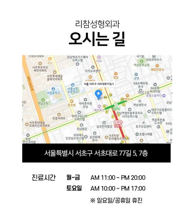 리참성형외과 [캐시닥 단독] 줄기세포 치료 이벤트, 시술 상세 이미지