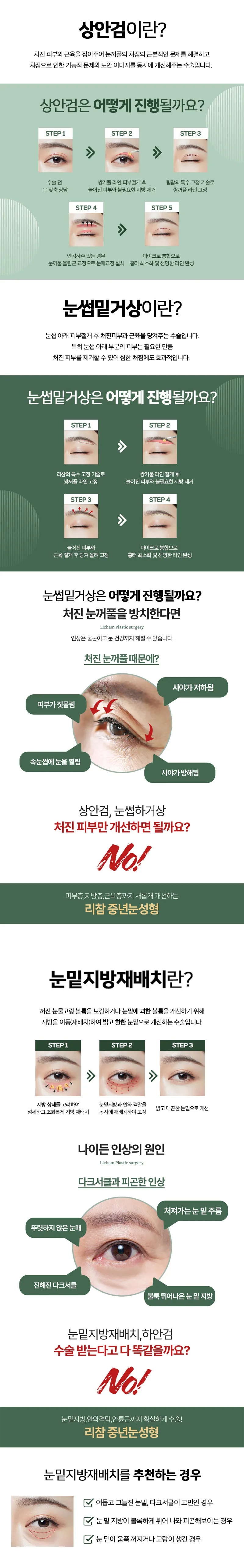 리참성형외과 [캐시닥 단독] 리참 중년눈성형 이벤트, 시술 상세 이미지