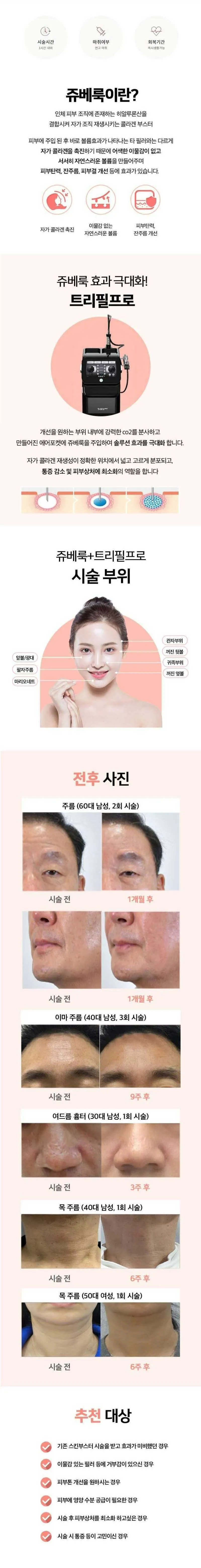 리참성형외과 캐시닥 단독☆리참 콜라겐 생성 쥬베룩 이벤트, 시술 상세 이미지