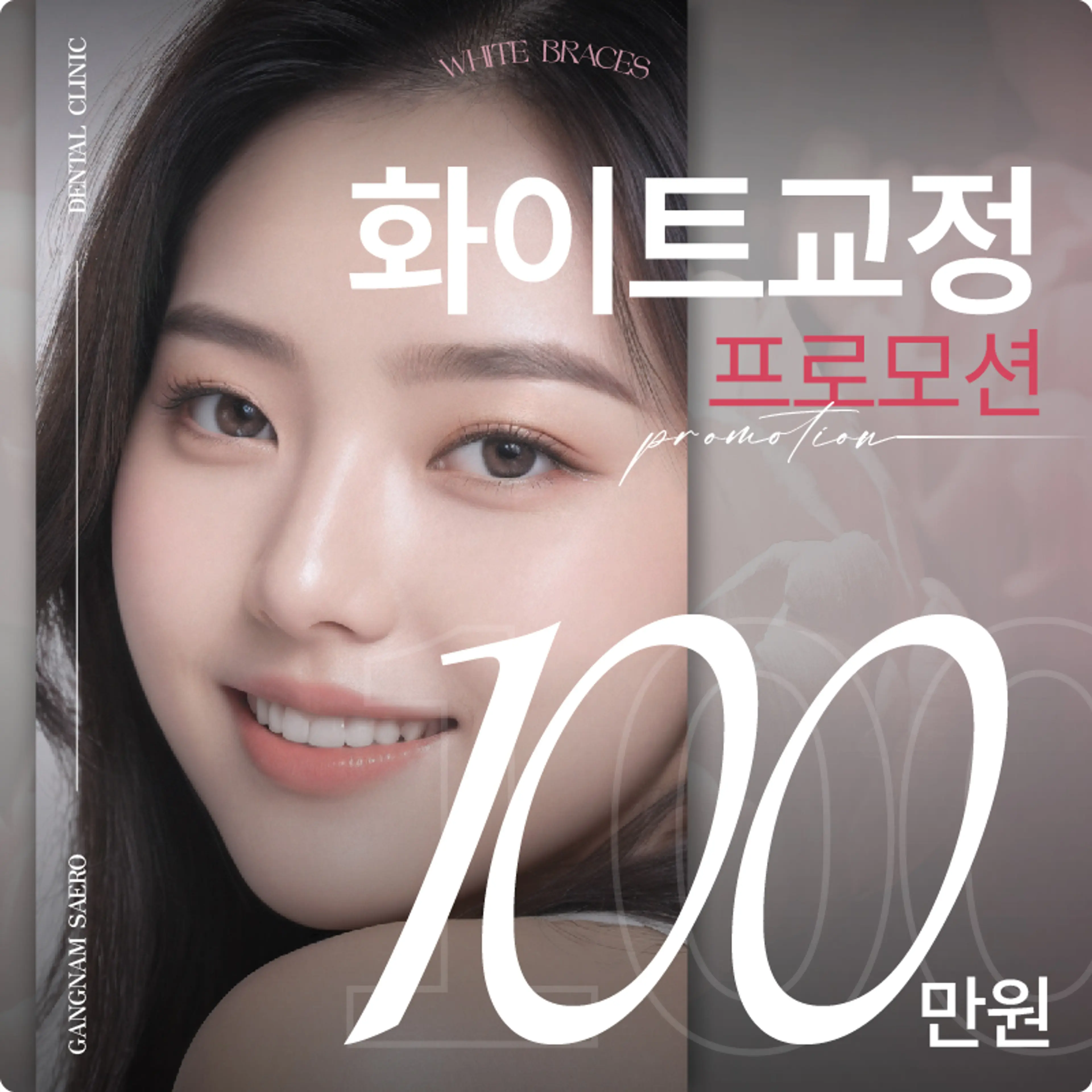 강남새로치과 화이트 교정