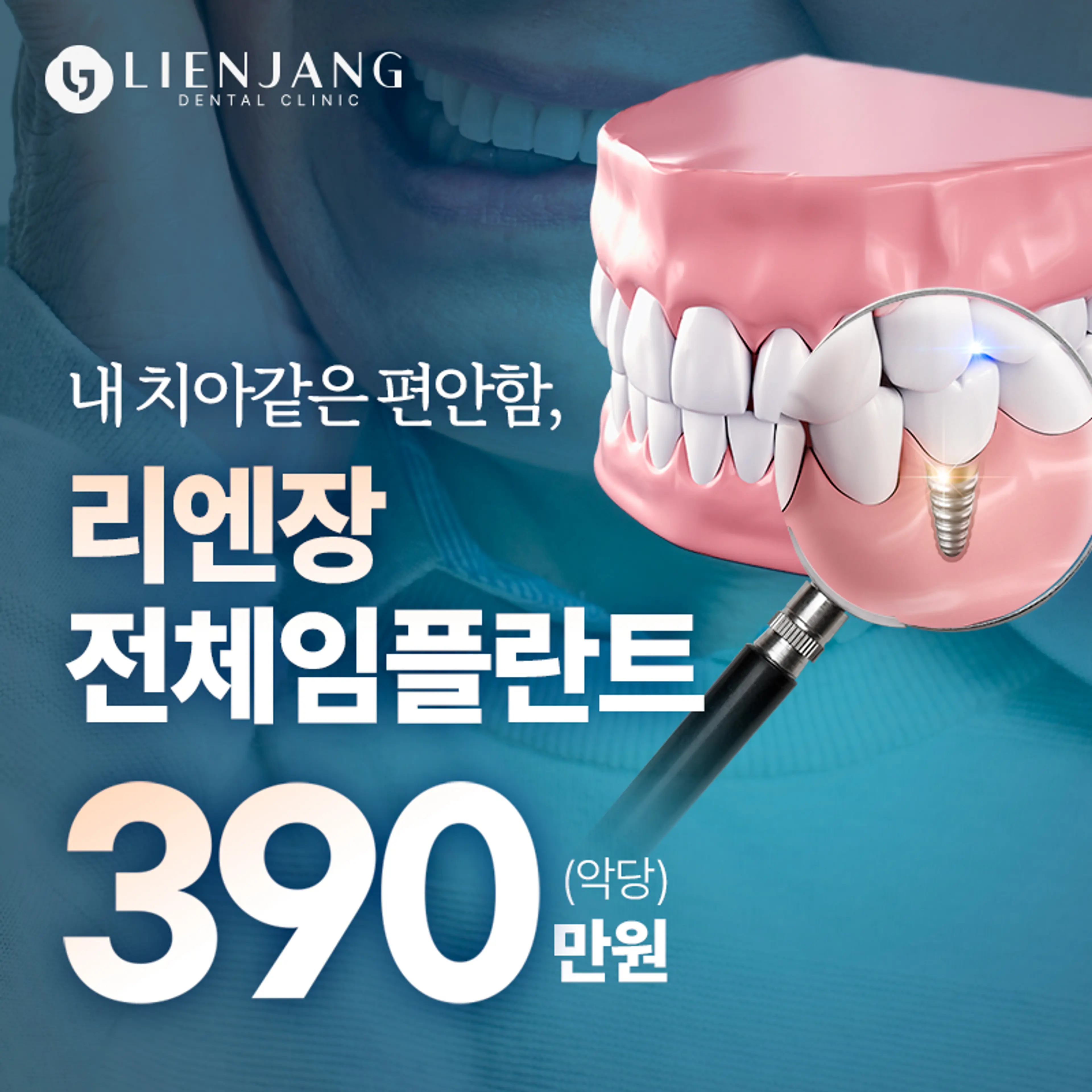 내 치아같은 편안한 전체임플란트