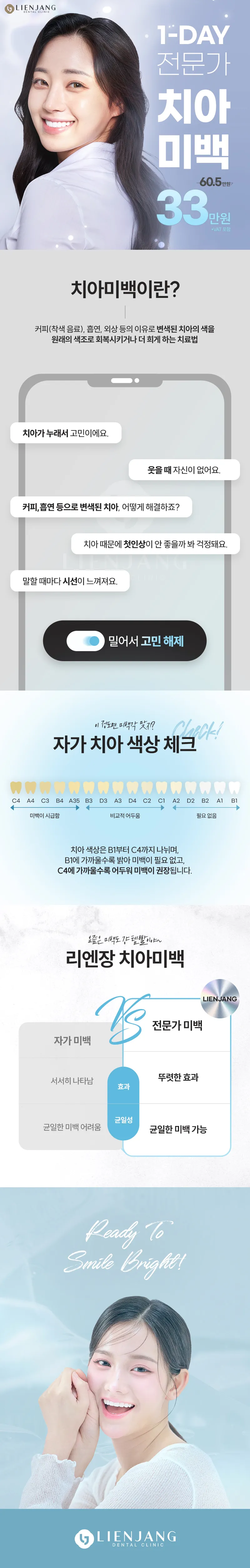 리엔장치과 누런 치아를 반짝이는 흰 치아로 이벤트, 시술 상세 이미지