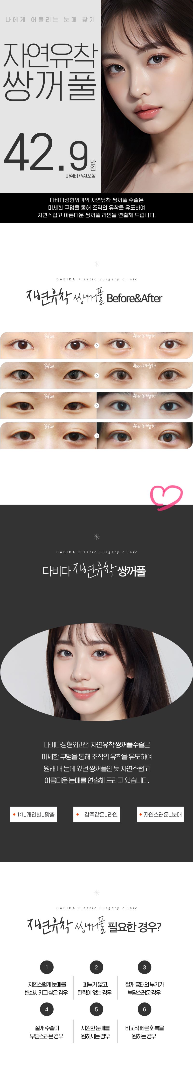 다비다성형외과의원 다비다 자연유착쌍꺼풀 이벤트, 시술 상세 이미지