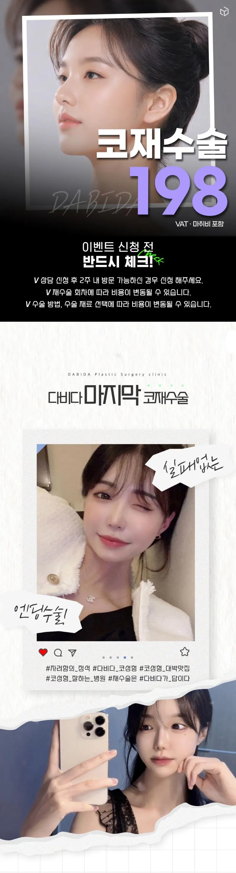 다비다성형외과의원 다비다 마지막 코재수술 이벤트, 시술 상세 이미지