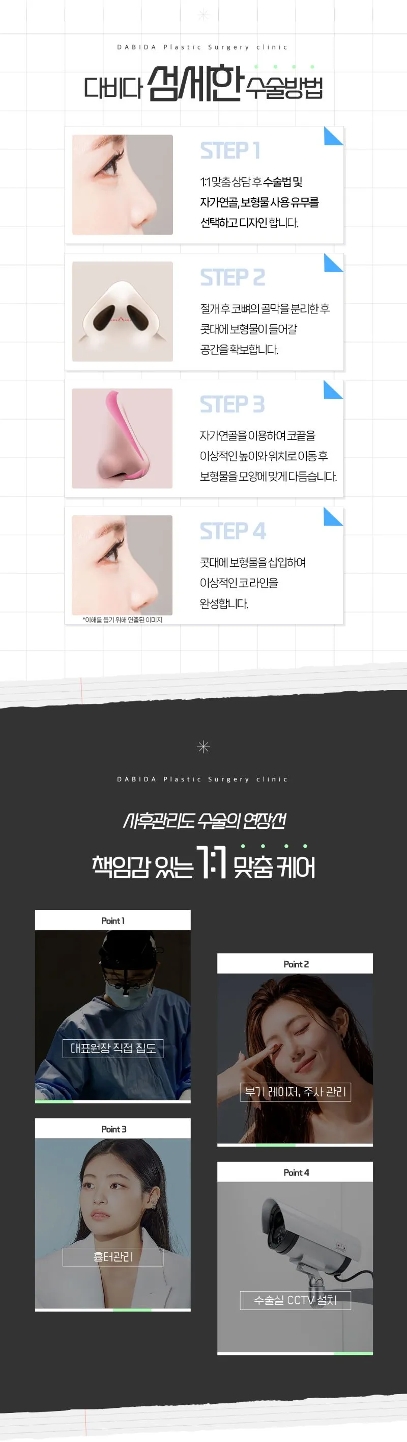 다비다성형외과의원 다비다 퓨어 첫코성형 이벤트, 시술 상세 이미지