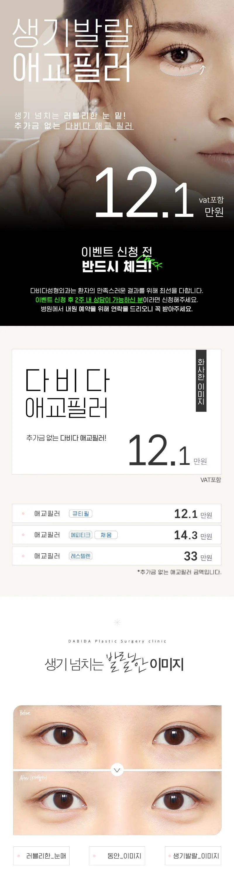 다비다성형외과의원 생기발랄 애교필러 이벤트, 시술 상세 이미지