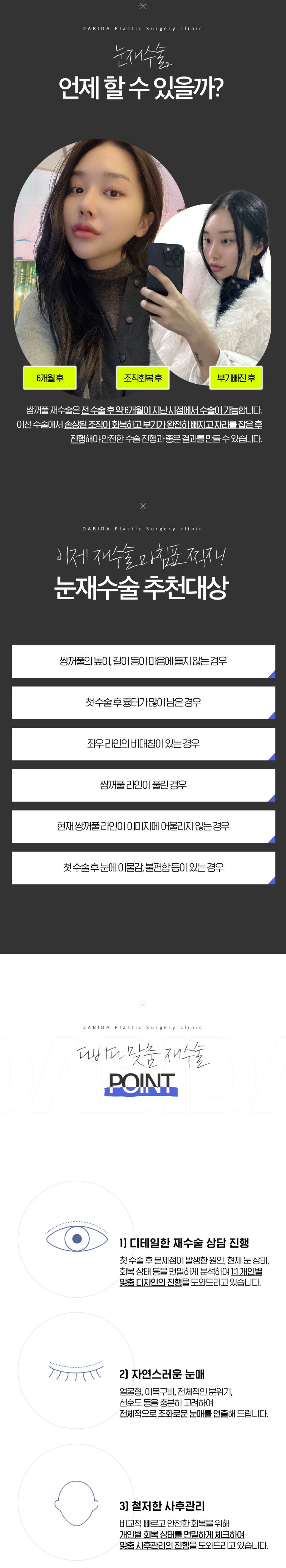 다비다성형외과의원 재수술 마침표 쌍꺼풀재수술 이벤트, 시술 상세 이미지