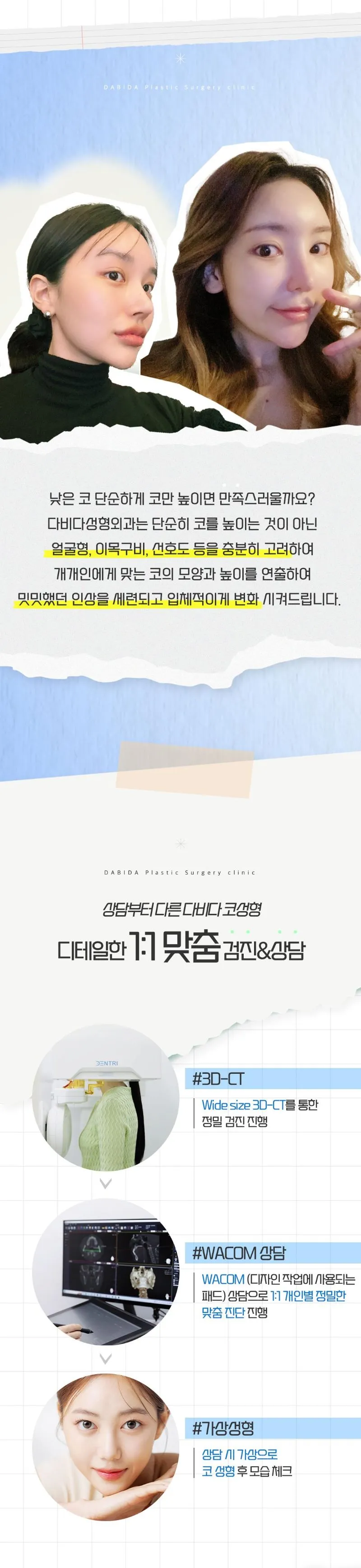 다비다성형외과의원 다비다 퓨어 첫코성형 이벤트, 시술 상세 이미지