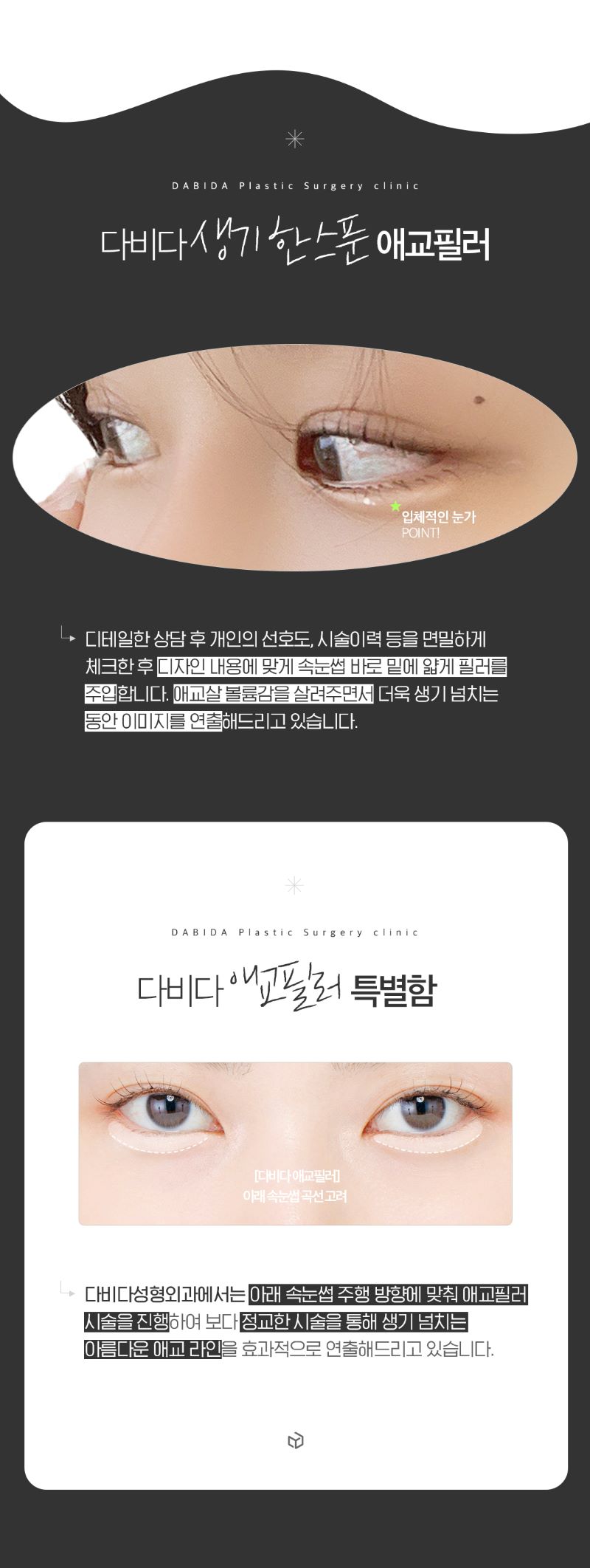 다비다성형외과의원 생기발랄 애교필러 이벤트, 시술 상세 이미지