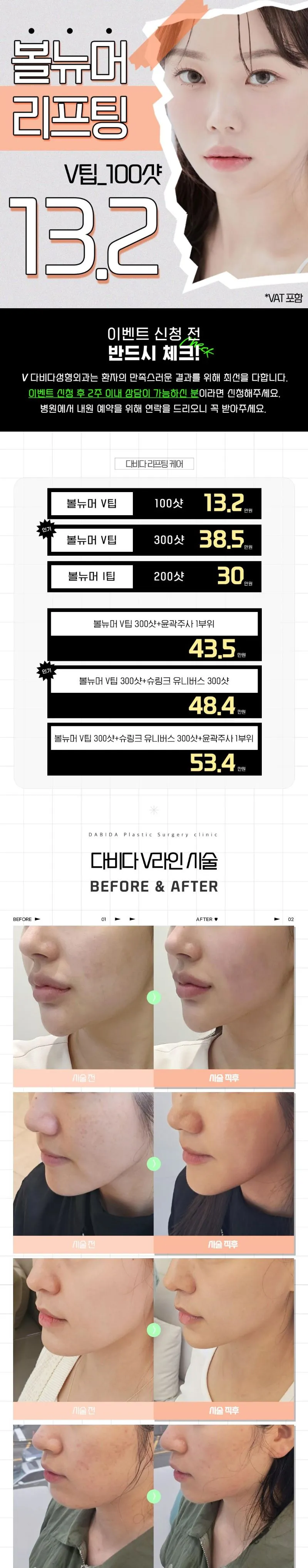다비다성형외과의원 탄력 쫀쫀 볼뉴머리프팅 이벤트, 시술 상세 이미지